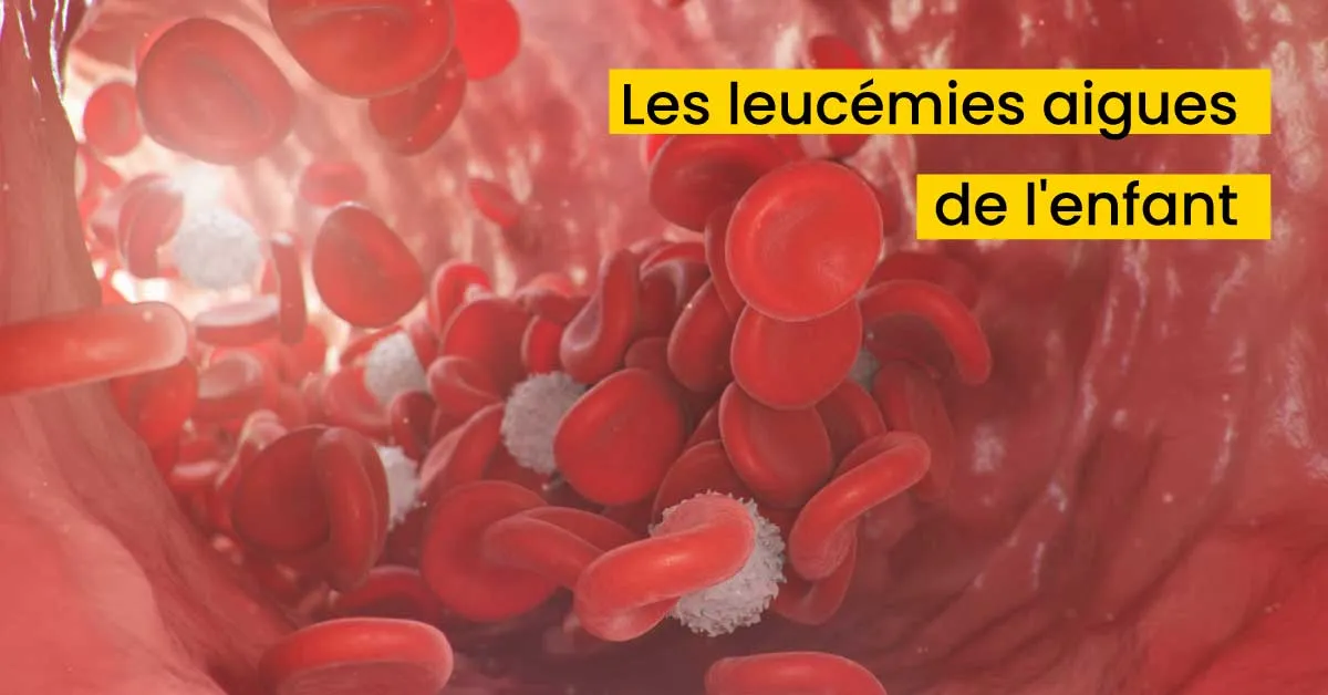 Les leucémies aigues de l'enfant